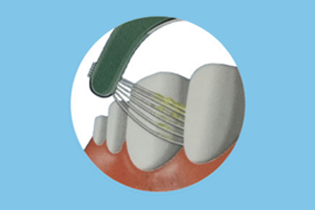 Công nghệ Buletedan